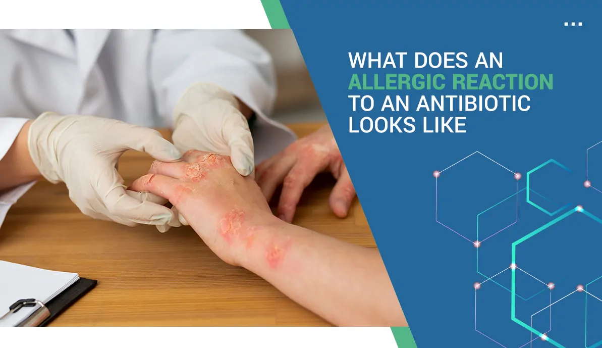 What does an allergic reaction to an antibiotic look like