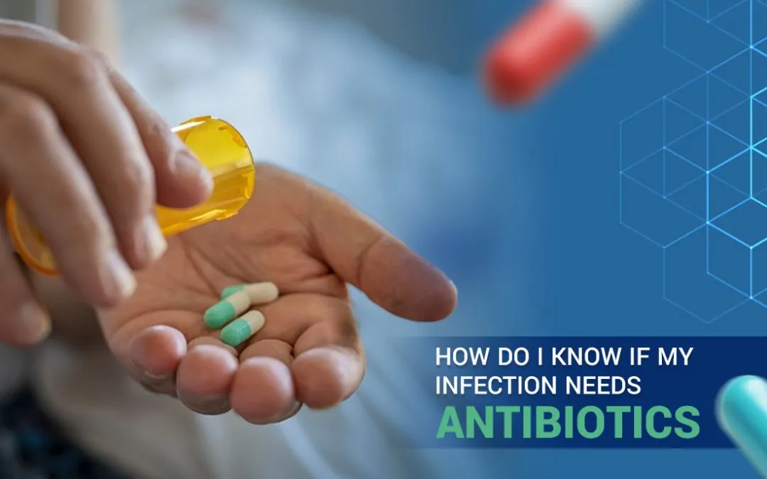 How do I know if my Infection needs Antibiotics